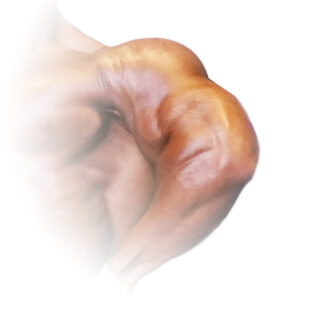 ARMS